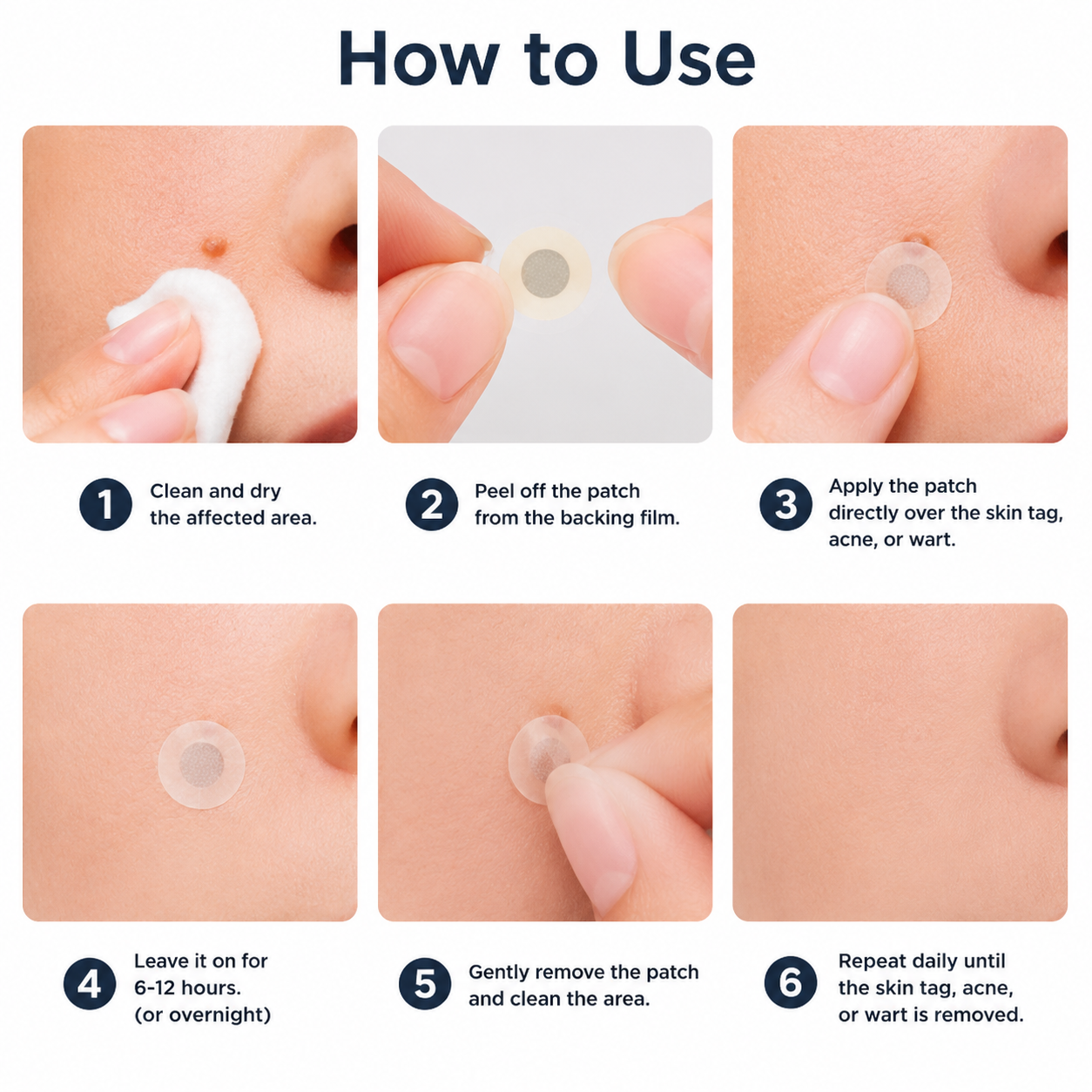 ✨Patch 2-en-1 Curalona® : Microneedle & Hydrocolloïde🍀 | Élimine les grains de beauté en relief, les verrues planes et les acrochordons | Aide à atténuer les rides, les cicatrices et les imperfections | Patch invisible adapté au visage et au corps