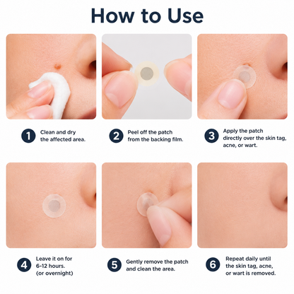 ✨Patch 2-en-1 Curalona® : Microneedle & Hydrocolloïde🍀 | Élimine les grains de beauté en relief, les verrues planes et les acrochordons | Aide à atténuer les rides, les cicatrices et les imperfections | Patch invisible adapté au visage et au corps