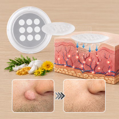✨Patch 2-en-1 Curalona® : Microneedle & Hydrocolloïde🍀 | Élimine les grains de beauté en relief, les verrues planes et les acrochordons | Aide à atténuer les rides, les cicatrices et les imperfections | Patch invisible adapté au visage et au corps